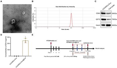Exendin-4-enriched exosomes from hUCMSCs alleviate diabetic nephropathy via gut microbiota and immune modulation